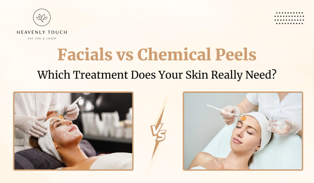 Facials vs Chemical Peels