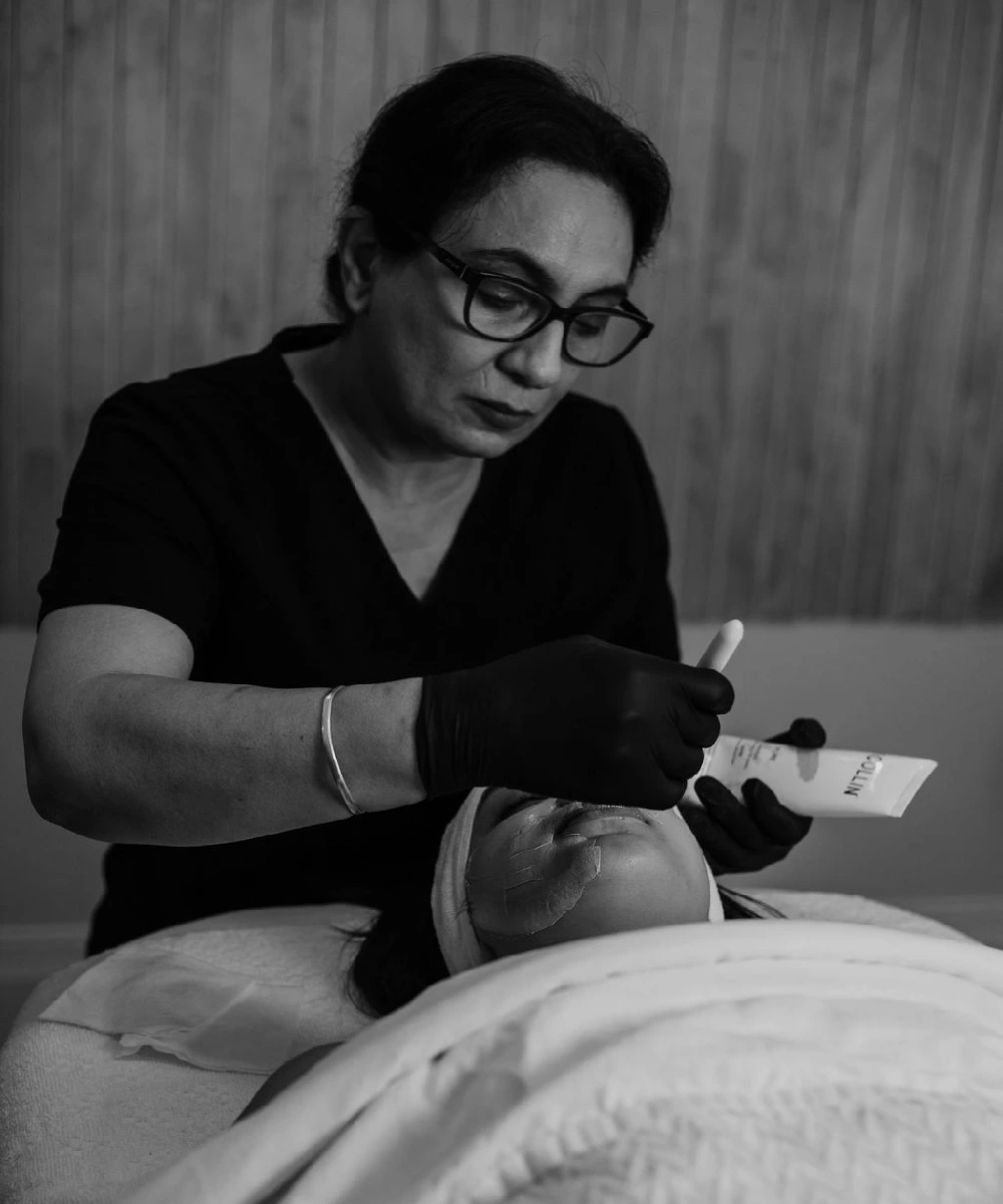 Chemical Peels Treatment