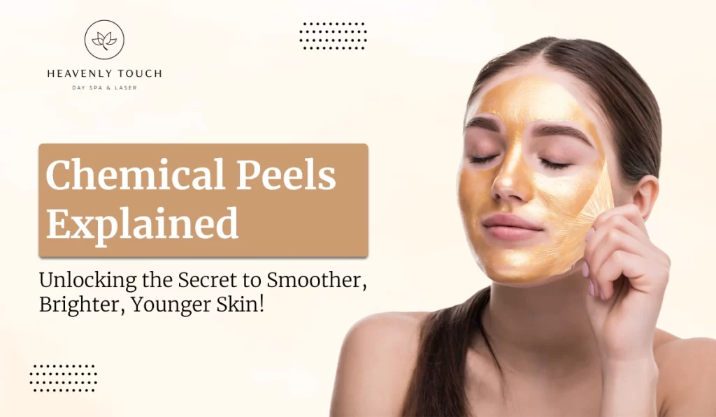 Chemical peels