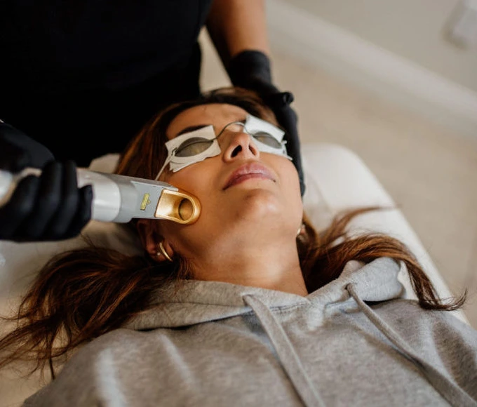 Laser Treatment in surrey, BC