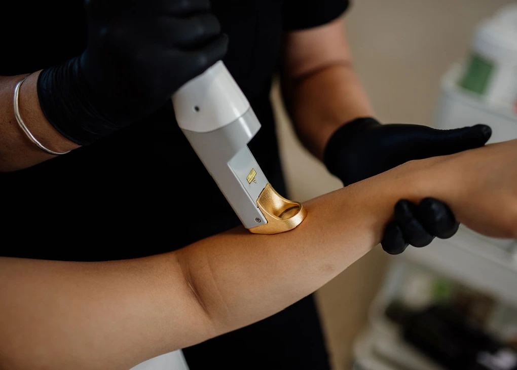 Laser hair Removel Treatement